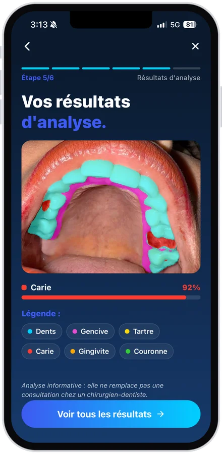 App, résultats de l’analyse